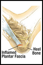 heal pain